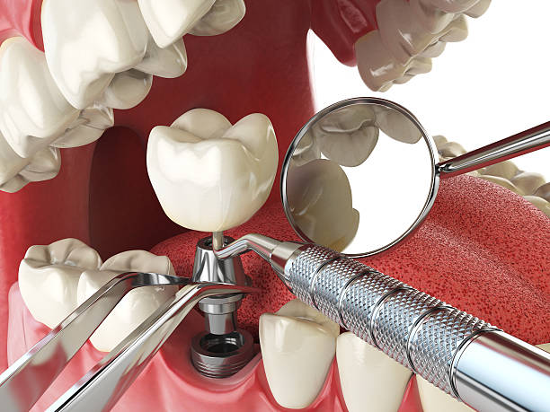 Best Emergency Cosmetic Dentistry (e.g., broken veneers) in Sheridan, WY